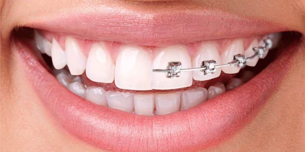 Ortodonti-Nedir.jpg
